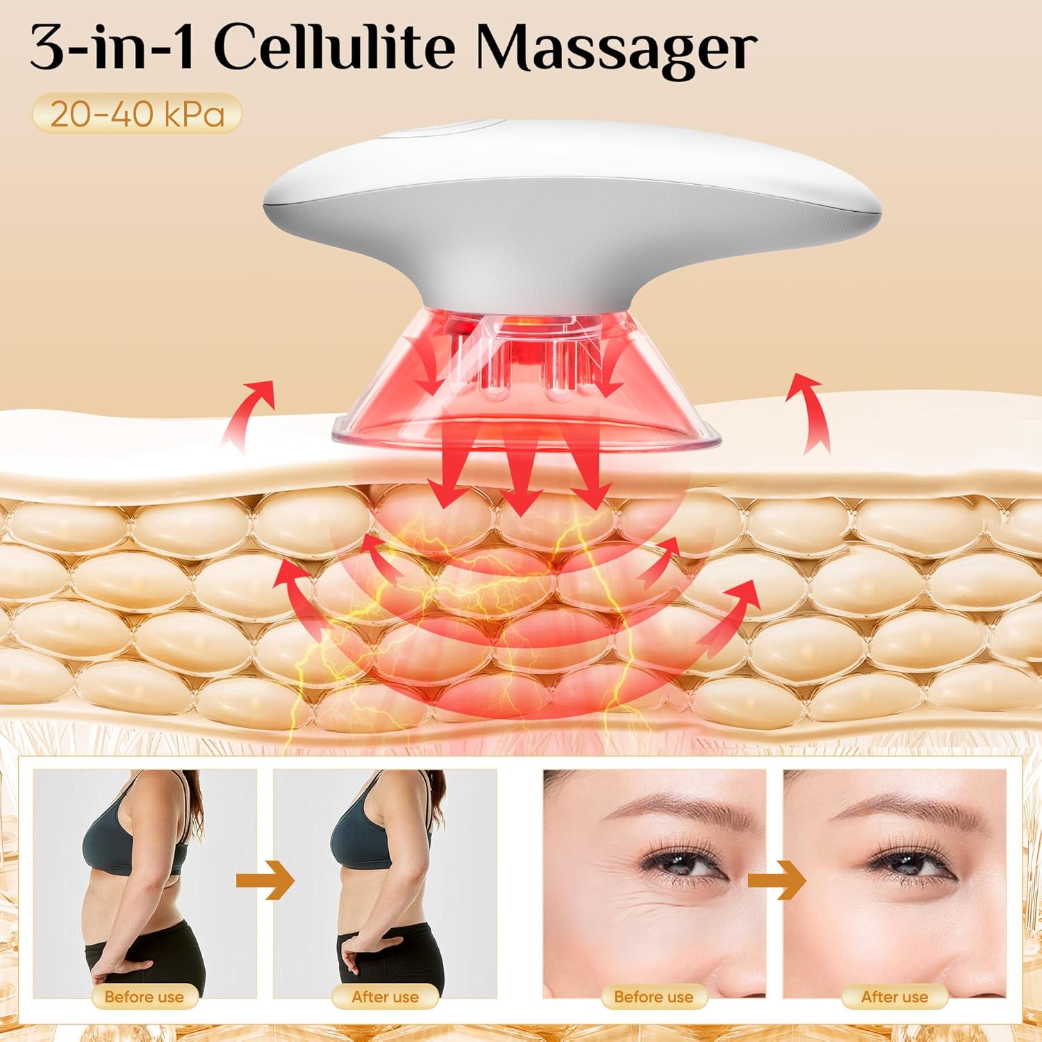 Hysist™ Body Sculptor